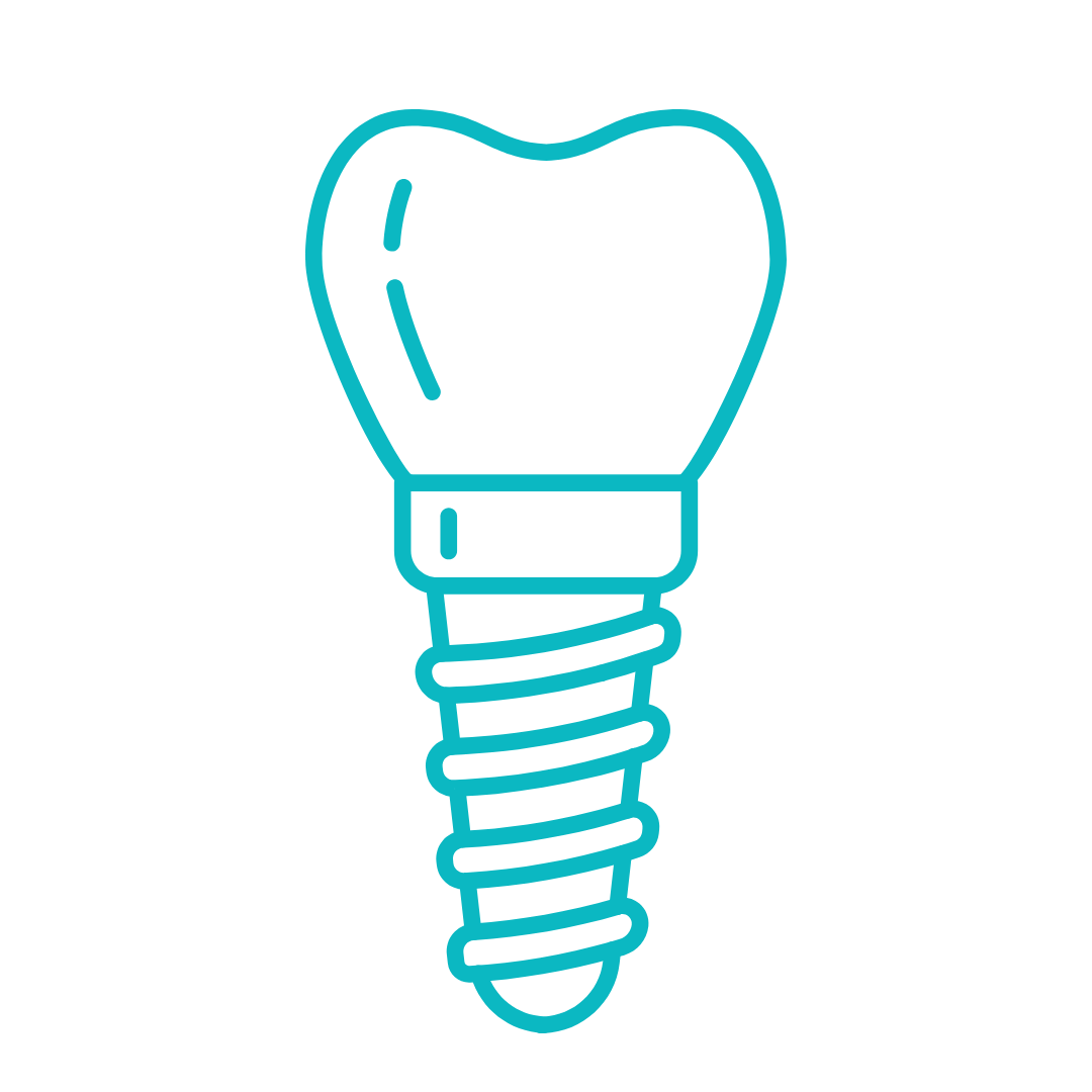 dental implants