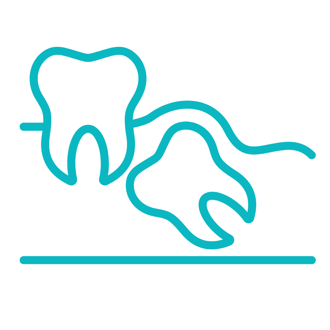 wisdom tooth removal