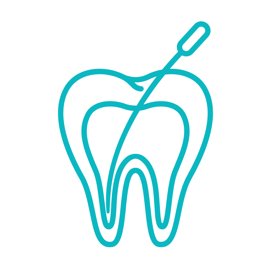root canal